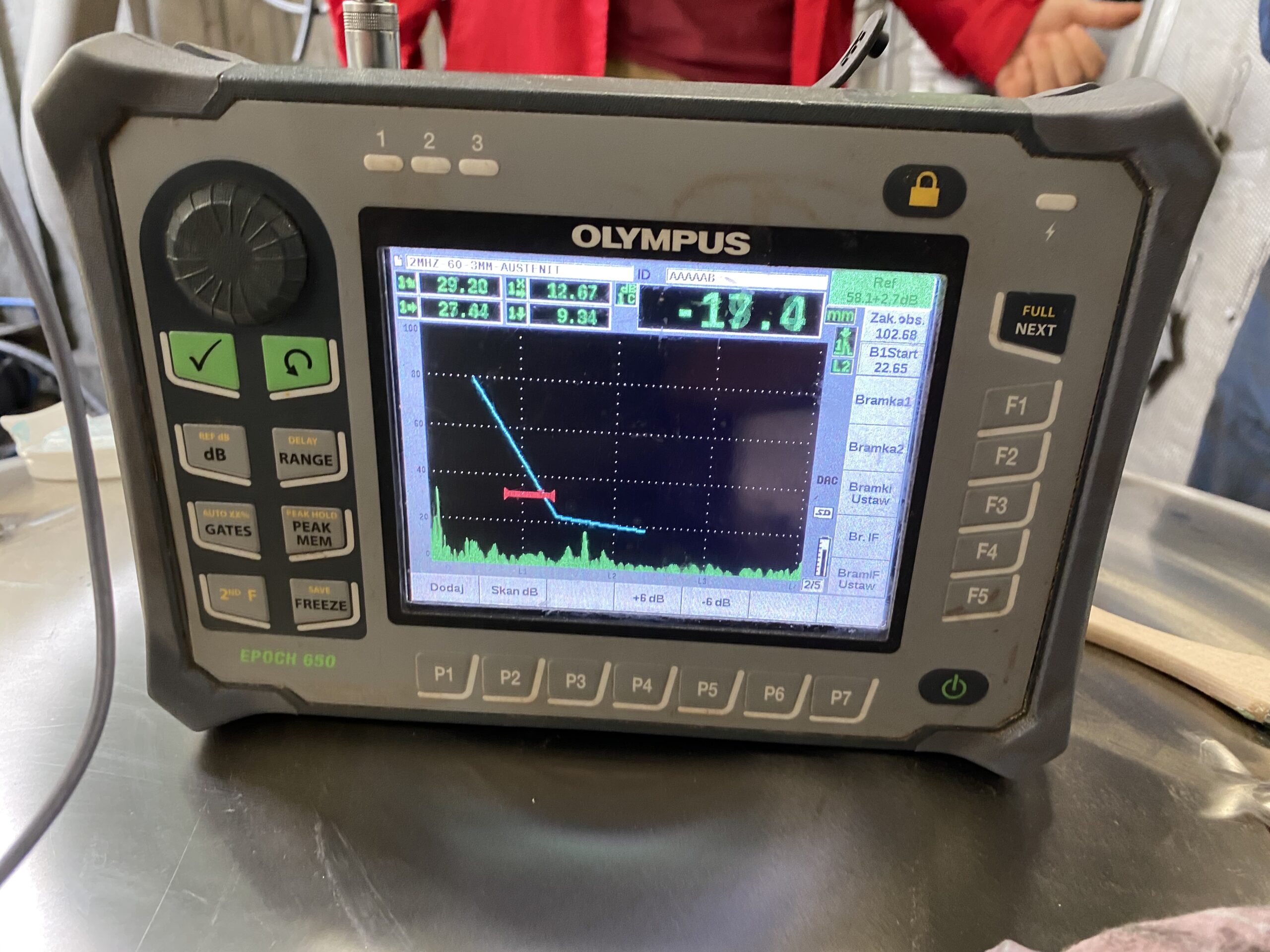 Badania ultradźwiękowe - techniki