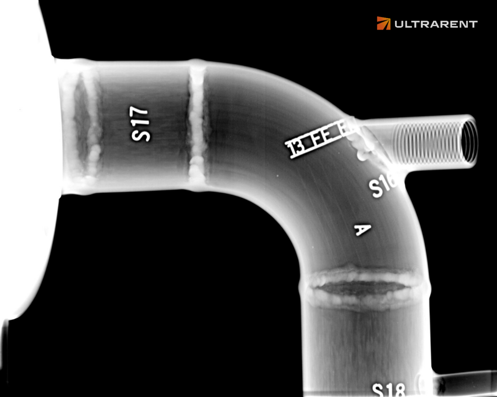 radiografia cyfrowa